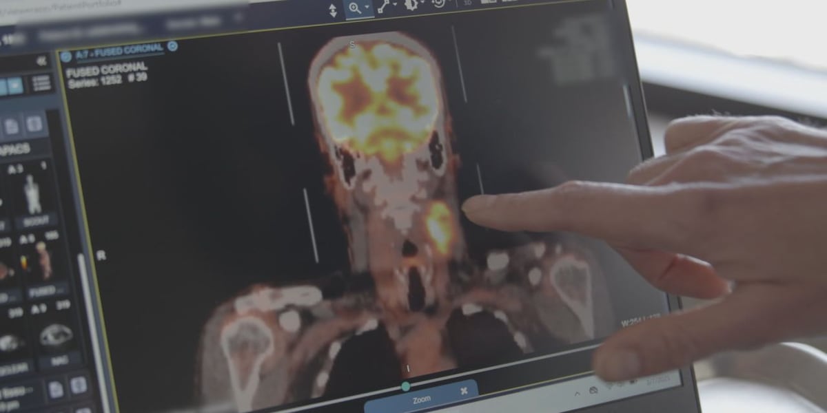 Understanding Head and Neck Cancer Understanding Head and Neck Cancer